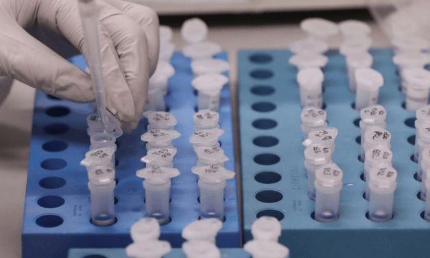 UFRJ desenvolve teste de baixo custo para detecção de covid-19